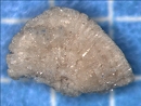 透磷钙石